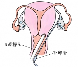 幼儿学画画，嘉兴捐卵宝宝学画画，学画画的好处，如何学画画