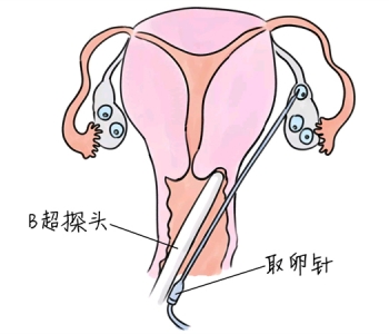 幼儿学画画，嘉兴捐卵宝宝学画画，学画画的好处，如何学画画